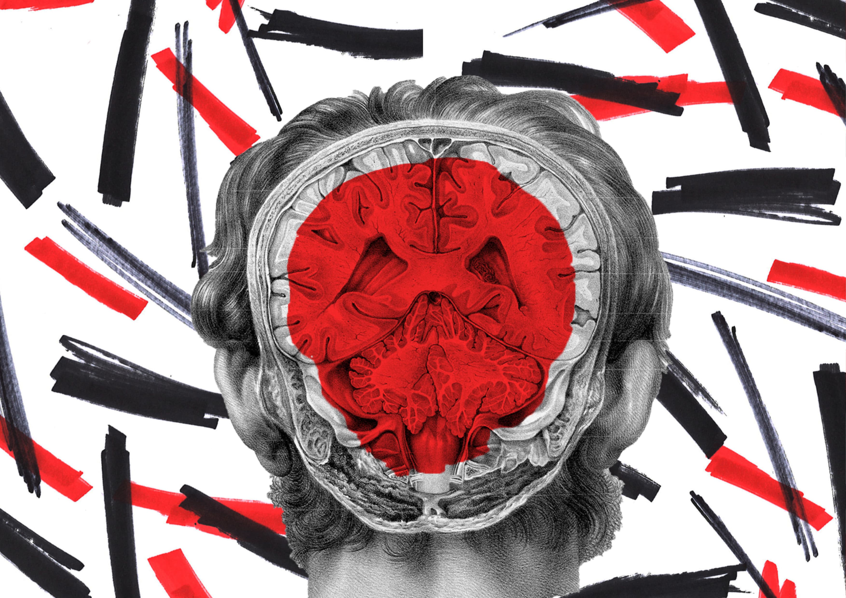 Graphic for University of the Underground: anatomical illustration shows a section cut through the back of a head revealing the brain, which is colored red. The background is white with red and black pen marks. 